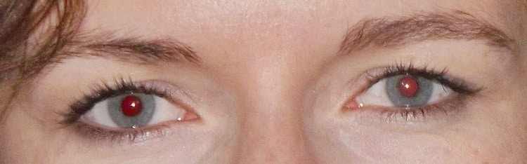 red-eyes-before