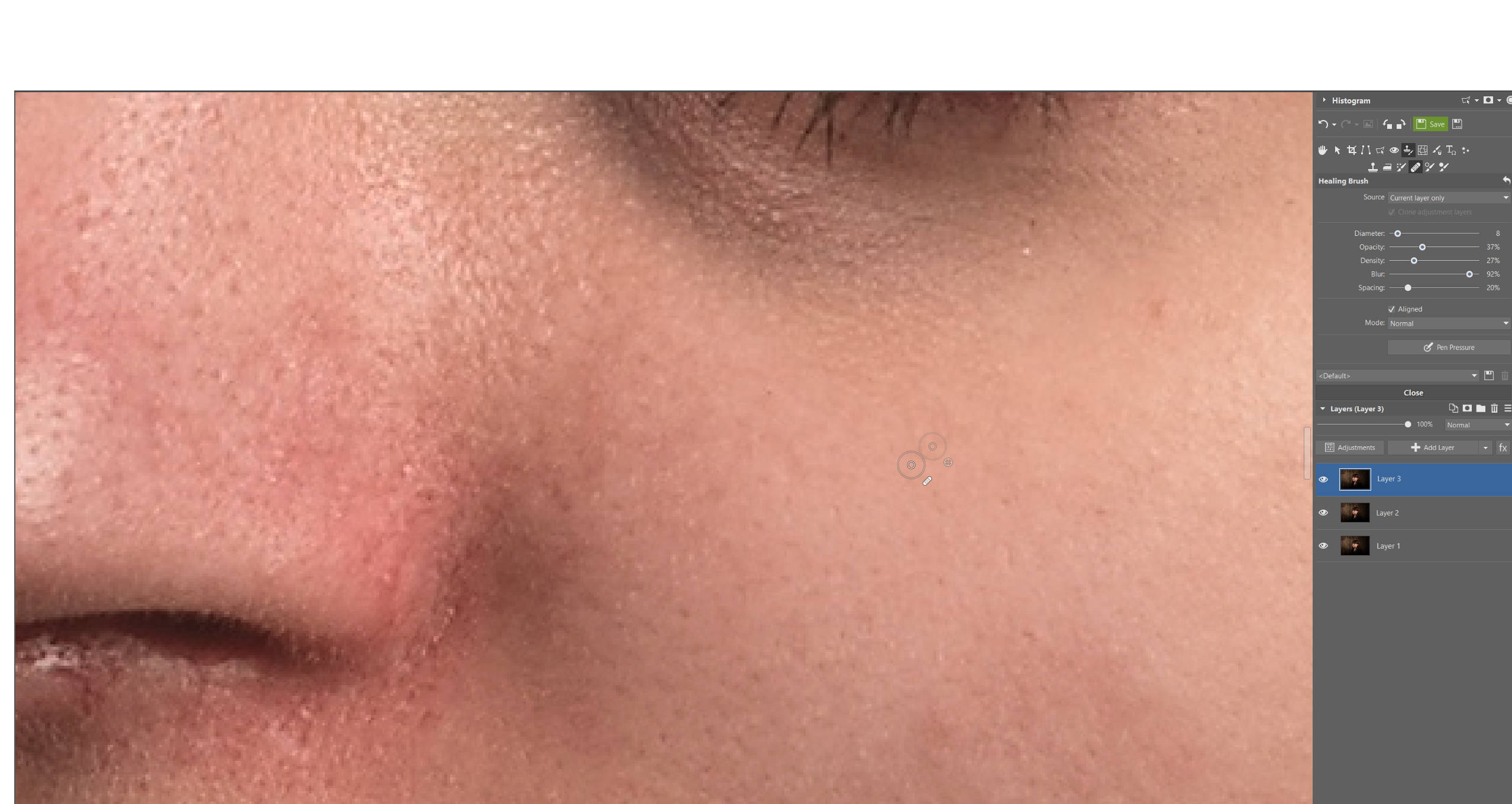 Retouching Problematic Skin