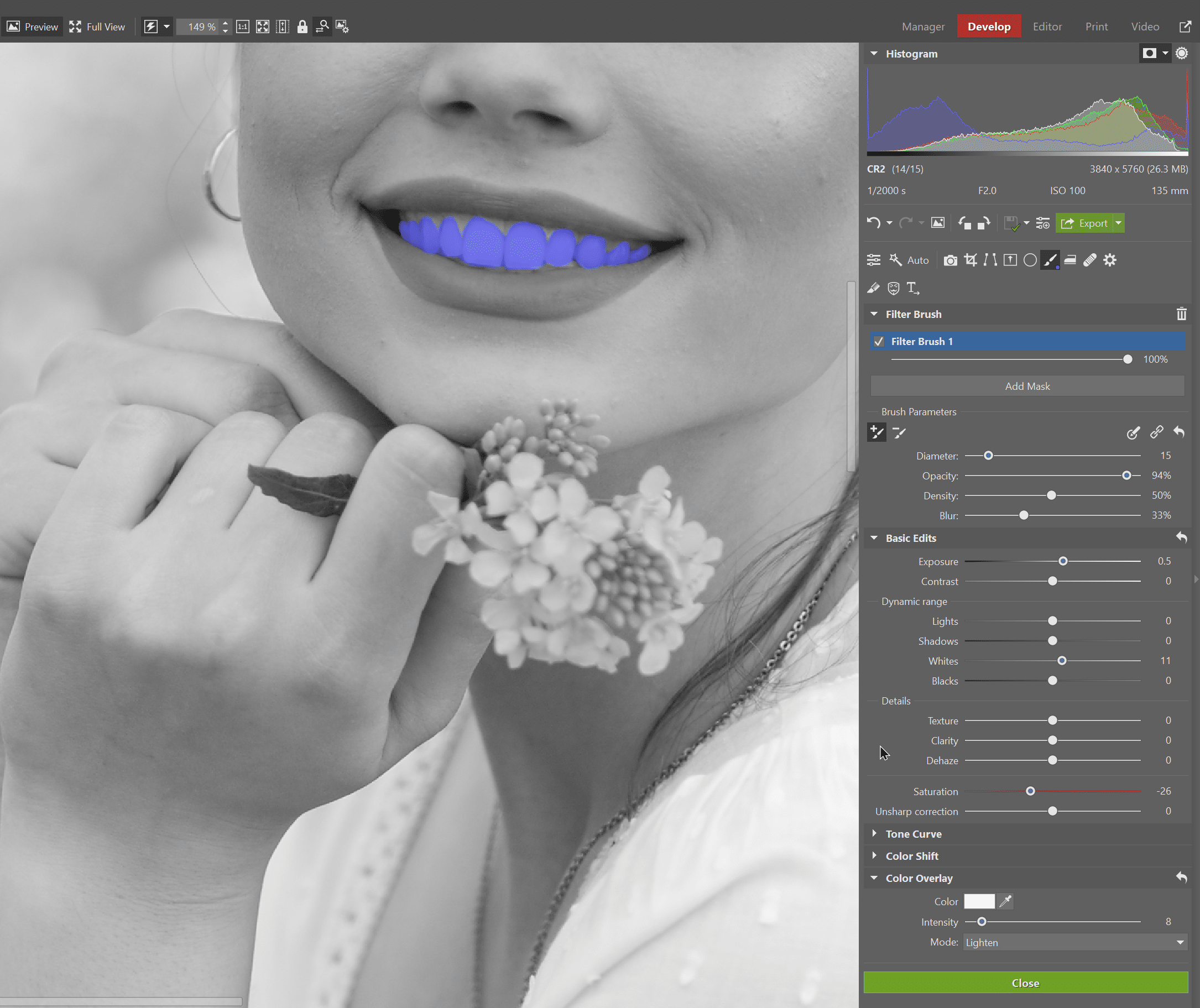 3 Quick Tips for Whitening Teeth