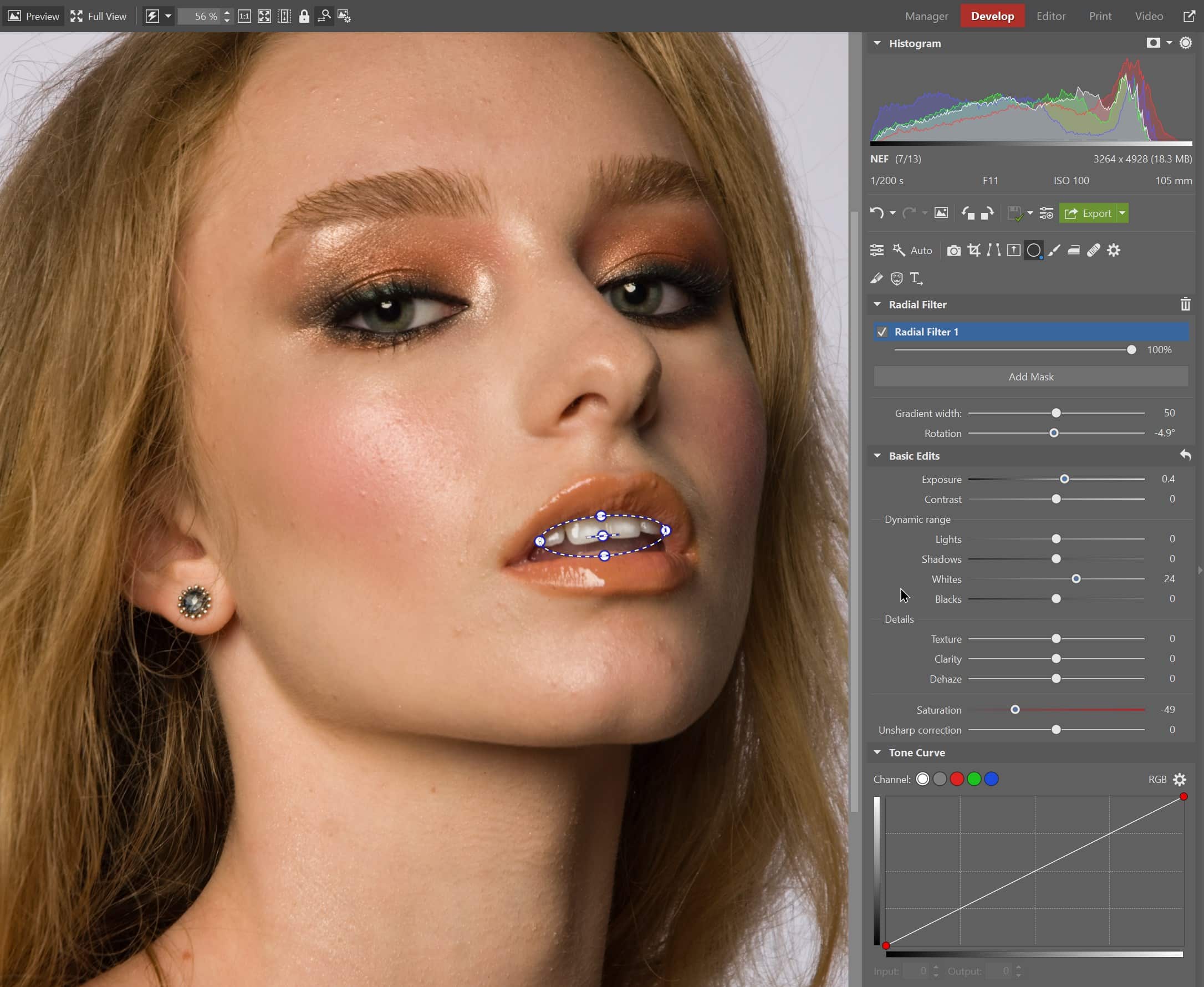 3 Quick Tips for Whitening Teeth